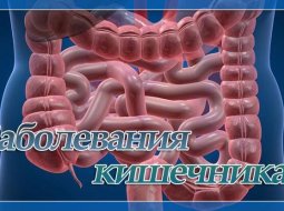 Заболевания кишечника: симптомы, признаки болезни и их лечение