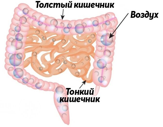 Процесс газообразования в кишечнике