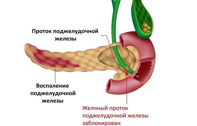 Протоки поджелудочной железы